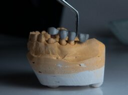Precision and Innovation How 3D Printing is Shaping the Next Generation of Dental Implants