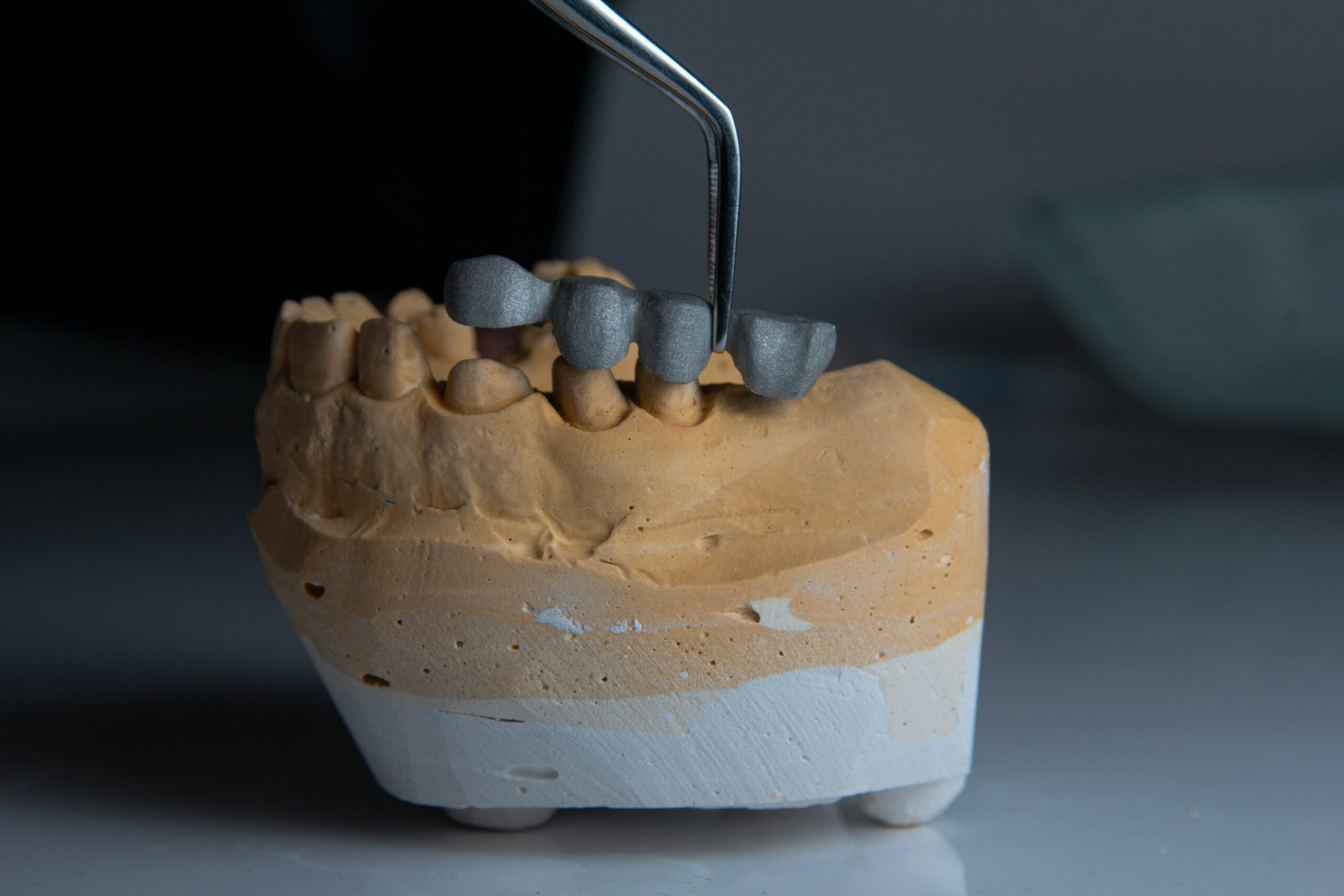 Precision and Innovation How 3D Printing is Shaping the Next Generation of Dental Implants